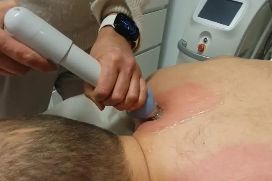 KivutPois.fi:n laserterapia jäätyneen olkapään hoitoon parantaa liikkuvuutta tehokkaasti. KivutPois.fi:n laserterapia jäätyneen olkapään hoitoon parantaa liikkuvuutta tehokkaasti.