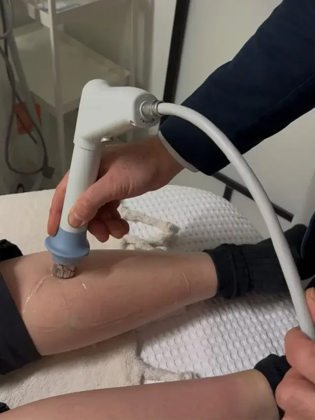 Nykyaikainen laserterapia jännetulehduksen hoitoon KivutPois.fi:n laitteistolla. Nykyaikainen laserterapia jännetulehduksen hoitoon KivutPois.fi:n laitteistolla.