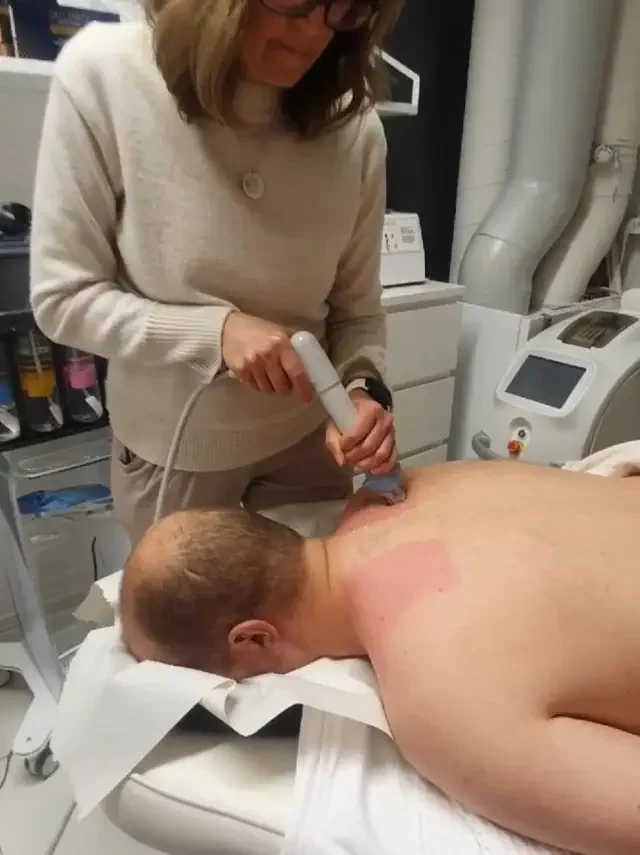 Laserhoito tenniskyynärpään ja muiden kyynärpään rasitusvammojen hoitoon. Laserhoito tenniskyynärpään ja muiden kyynärpään rasitusvammojen hoitoon.