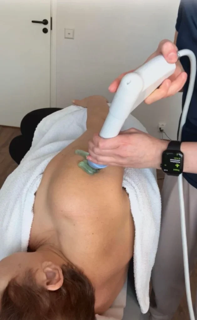 Iskuaaltohoito voidaan tehdä olkapäähän hoidossa fysioterapiassa